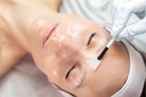 Chemical Peels Amanda Kemp Aesthetics Glasgow