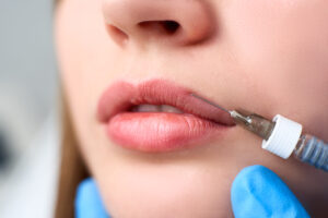 Dermal Fillers Amanda Kemp Aesthetics Glasgow
