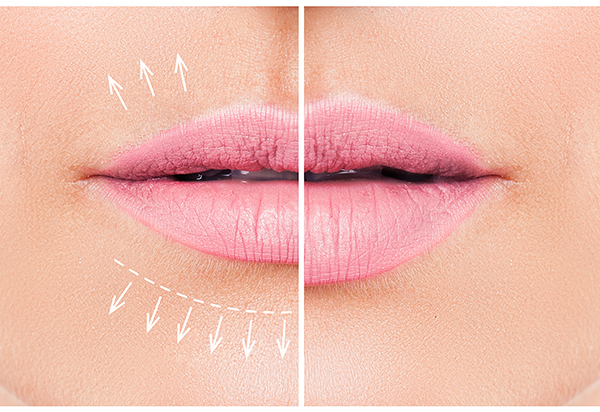 Dermal Fillers Amanda Kemp Aesthetics Glasgow